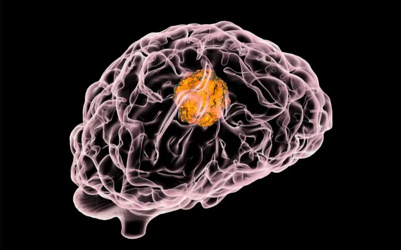 今年会助力 | 璧辰医药ABM-1310获美国FDA孤儿药资格认证，用于治疗携带BRAF V600突变的脑胶质母细胞瘤患者